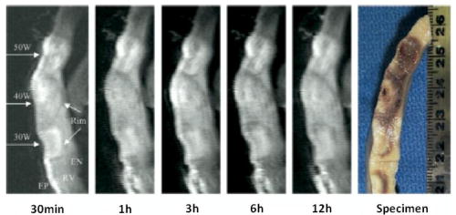 An external file that holds a picture, illustration, etc., usually as some form of binary object. The name of referred object is rmmj-1-2_e0015_Figure05.jpg